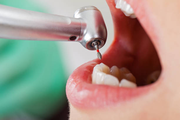 Best Emergency Wisdom Teeth Removal in Heber Springs, AR